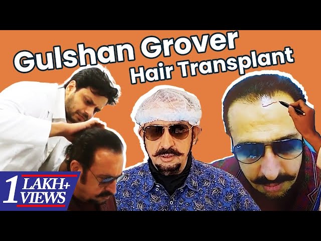 Top Clinics for Hair Transplant in Mohali  Chandigarh Help