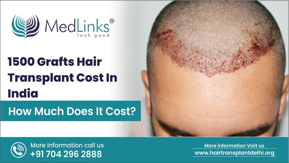 1500 Grafts Hair Transplant Cost India Medlinks