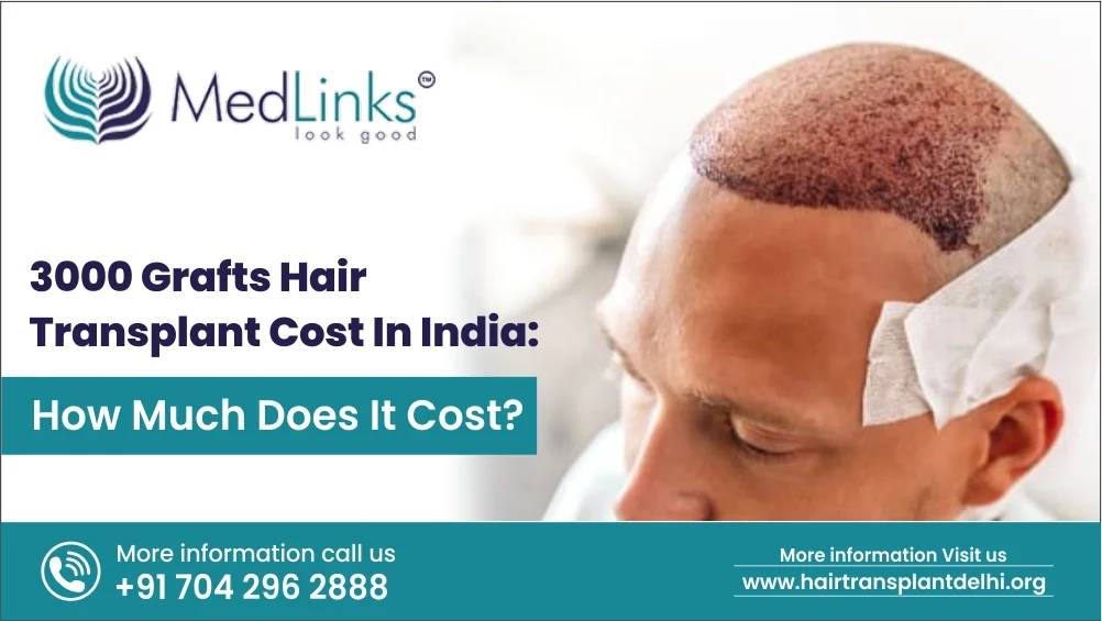 3000 Grafts Hair Transplant Cost In India Medlinks